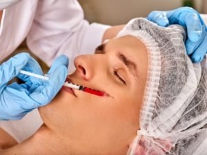 A person getting dermal fillers injected