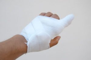 Broken finger accident at work