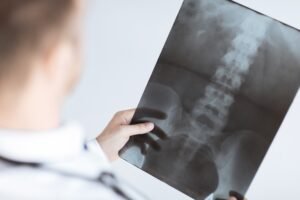 A doctor examining a scan of a spine