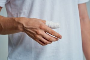 Man with thumb injury on one arm.