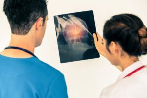 Doctors look at a scan of a serious brain injury.