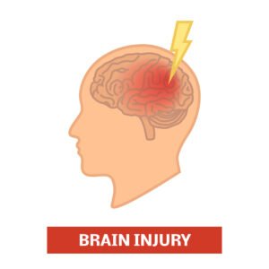 An illustration of a brain injury, where the injured area is highlighted in red and has a lightening bolt next to it. 