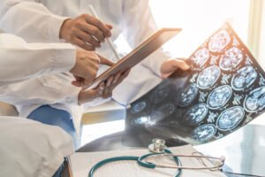 Doctors look at brain scans showing blood flow blocked by a clot.
