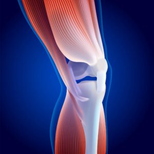 Graphic showing a knee cartilage tear injury