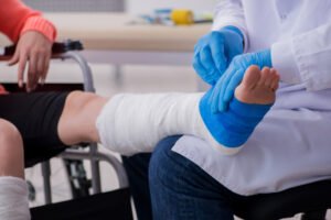 A person has a broken leg treated.