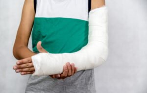 A person has a fractured arm in a cast.