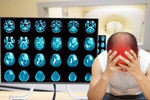 A man holds his head having sustained mild head injuries.