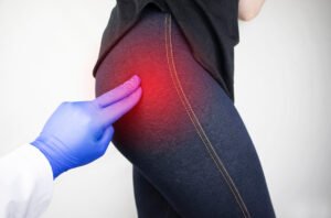 A woman with hip pain being pressed on by gloved fingers.