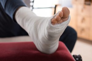 A man sat at home with his foot in a cast