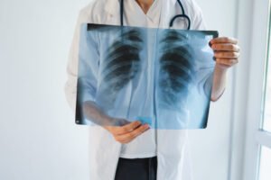 A doctor is examining an X-ray of a patient's chest